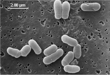 Corynebacterium glucuronolyticum. Corynebacterium diphtheriae электронная микроскопия. Corynebacterium glutamicum. Brevibacterium lactofermentum. Спороцидные бактерии.