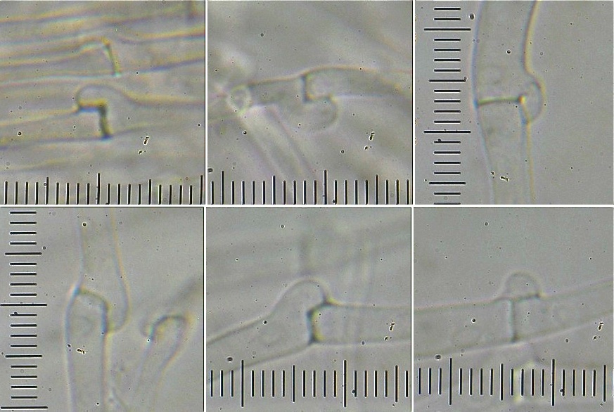 Анастамоз микроскопия.jpg