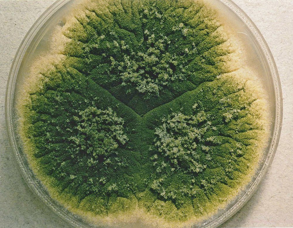 1200px-Aspergillus_parasiticus_UAMH3108.jpg